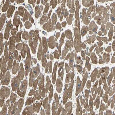 Immunohistochemistry-Paraffin: ANKRD15 Antibody [NBP1-90167]