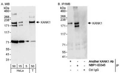Western Blot: ANKRD15 Antibody [NBP1-03345]