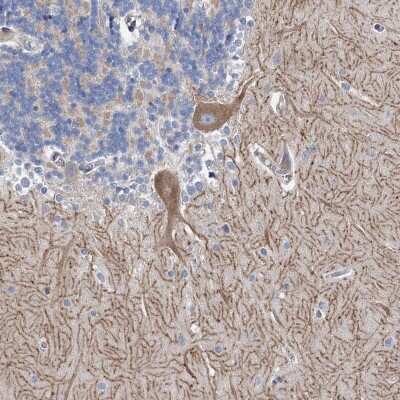 Immunohistochemistry-Paraffin: ANKRD16 Antibody [NBP1-84178]