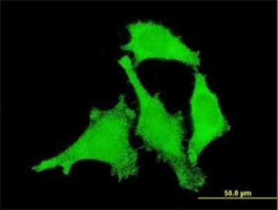 Immunocytochemistry/ Immunofluorescence: ANKRD17 Antibody (1D12) [H00026057-M03]