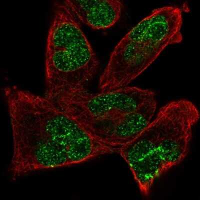 Immunocytochemistry/ Immunofluorescence: ANKRD17 Antibody [NBP2-57107]