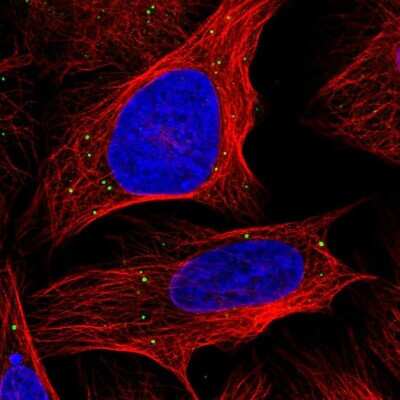 Immunocytochemistry/ Immunofluorescence: ANKRD2 Antibody [NBP1-91669]