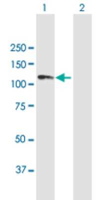 Western Blot: ANKRD20A1 Antibody [H00084210-B02P]