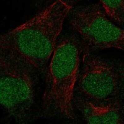 Immunocytochemistry/ Immunofluorescence: ANKRD20A3 Antibody [NBP3-17149]