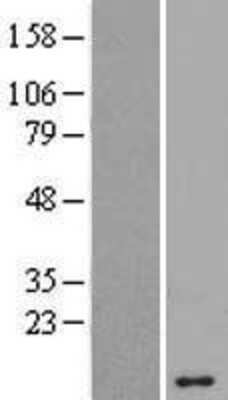 Western Blot: ANKRD20A5 Overexpression Lysate [NBL1-13063]