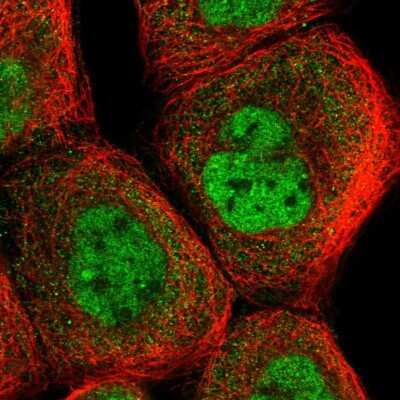 Immunocytochemistry/ Immunofluorescence: ANKRD23 Antibody [NBP1-90599]