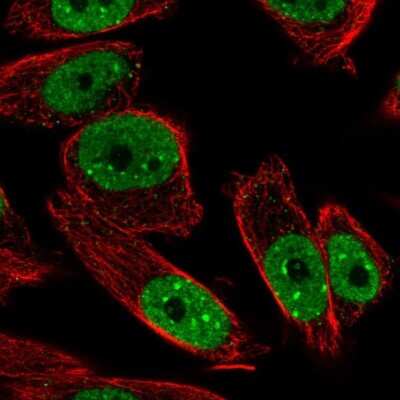 Immunocytochemistry/ Immunofluorescence: ANKRD29 Antibody [NBP2-33564]