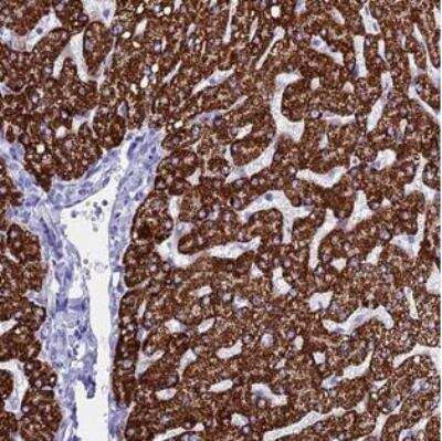 Immunohistochemistry-Paraffin: ANKRD29 Antibody [NBP2-30674]