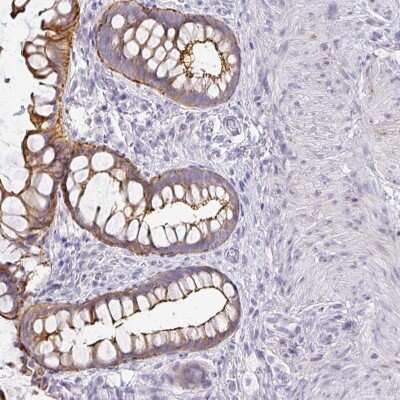 Immunohistochemistry-Paraffin: ANKRD29 Antibody [NBP2-33564]