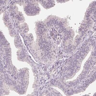 Immunohistochemistry-Paraffin: ANKRD31 Antibody [NBP2-49261]