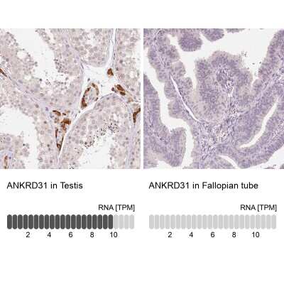 Immunohistochemistry-Paraffin: ANKRD31 Antibody [NBP2-49261]