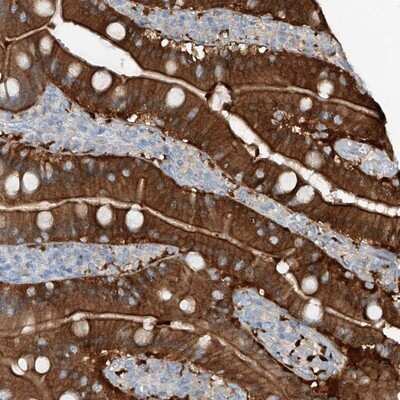 Immunohistochemistry-Paraffin: ANKRD34A Antibody [NBP1-90855]