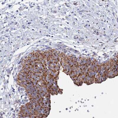 Immunohistochemistry: ANKRD34C Antibody [NBP2-33442]