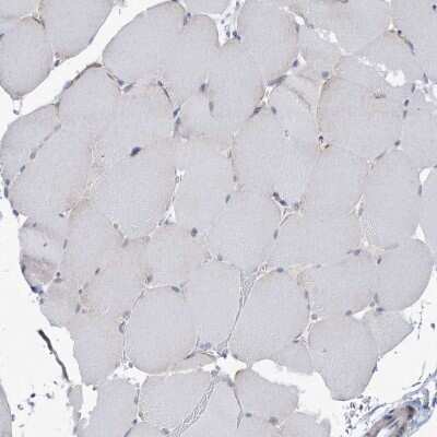 Immunohistochemistry-Paraffin: ANKRD35 Antibody [NBP1-93924]