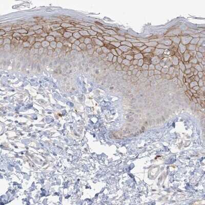 Immunohistochemistry-Paraffin: ANKRD35 Antibody [NBP1-93924]