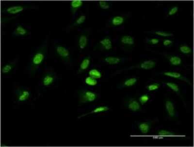 Immunocytochemistry/ Immunofluorescence: ANKRD37 Antibody (6E8) [H00353322-M02]