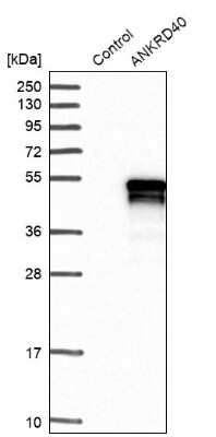 Western Blot: ANKRD40 Antibody [NBP1-93515]