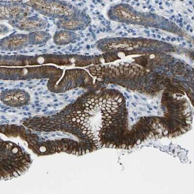 Immunohistochemistry-Paraffin: ANKRD46 Antibody [NBP1-94147]