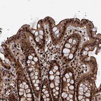Immunohistochemistry-Paraffin: ANKRD49 Antibody [NBP1-83902]