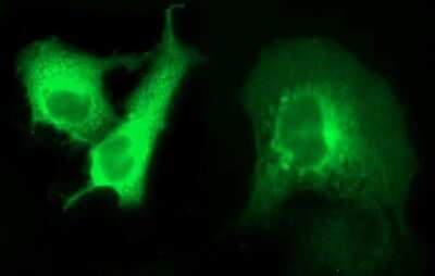 Immunofluorescence: ANKRD49 Antibody (OTI3E4) [NBP2-46526]