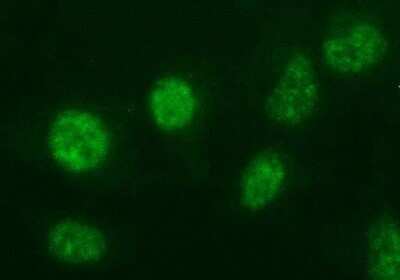 Immunofluorescence: ANKRD49 Antibody (OTI3E4) [NBP2-46526]