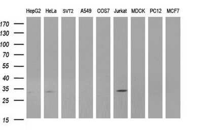 Western Blot: ANKRD49 Antibody (OTI3E4) [NBP2-46526]
