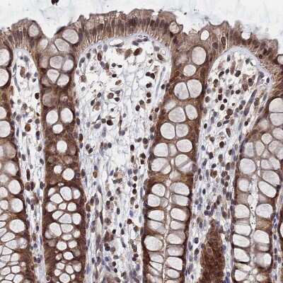 Immunohistochemistry-Paraffin: ANKRD5 Antibody [NBP1-85163]