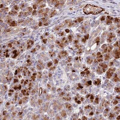 Immunohistochemistry-Paraffin: ANKRD50 Antibody [NBP1-93594]