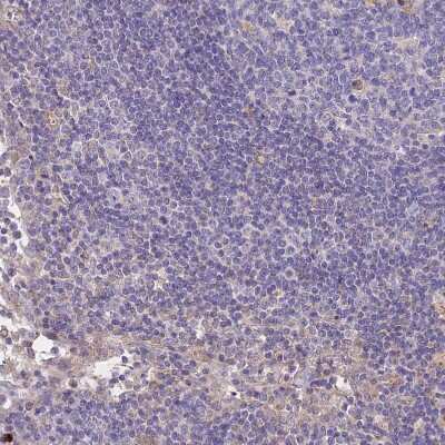 Immunohistochemistry-Paraffin: ANKRD50 Antibody [NBP1-93594]