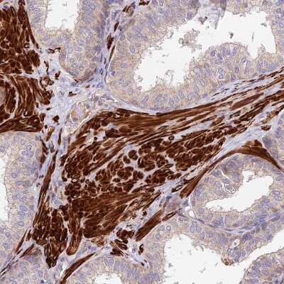 Immunohistochemistry-Paraffin: ANKRD50 Antibody [NBP1-93594]