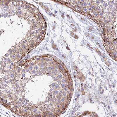 Immunohistochemistry-Paraffin: ANKRD50 Antibody [NBP1-93594]