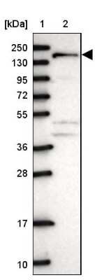 Western Blot: ANKRD50 Antibody [NBP1-93594]