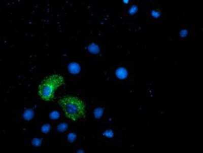 Immunocytochemistry/ Immunofluorescence: ANKRD53 Antibody (OTI1E1) [NBP2-00520]