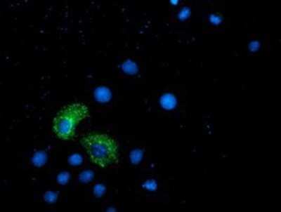 Immunocytochemistry/ Immunofluorescence: ANKRD53 Antibody (OTI1E1) - Azide and BSA Free [NBP2-72217]