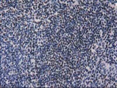Immunohistochemistry: ANKRD53 Antibody (OTI1E1) - Azide and BSA Free [NBP2-72217]