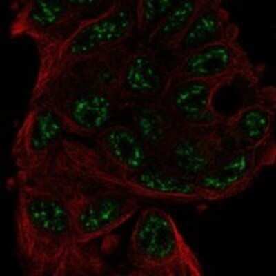 Immunocytochemistry/ Immunofluorescence: ANKRD55 Antibody [NBP3-17467]