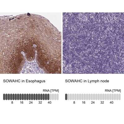 Immunohistochemistry-Paraffin: ANKRD57 Antibody [NBP2-49215]