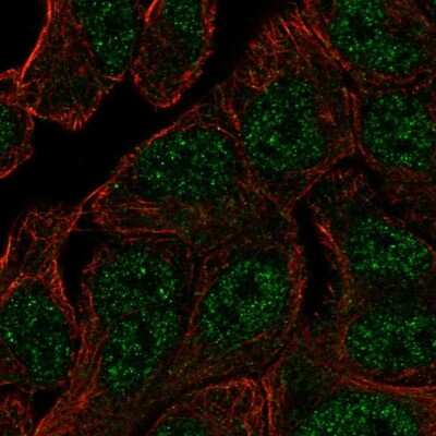 Immunocytochemistry/ Immunofluorescence: ANKRD65 Antibody [NBP2-39062]