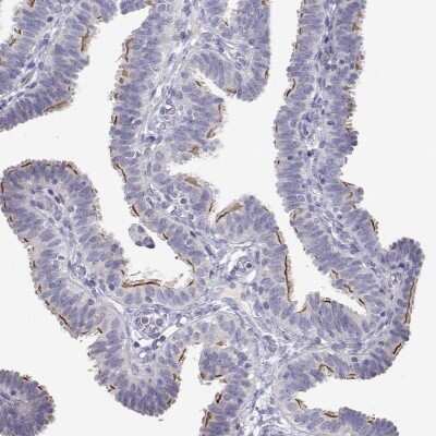 Immunohistochemistry-Paraffin: ANKRD65 Antibody [NBP2-39062]