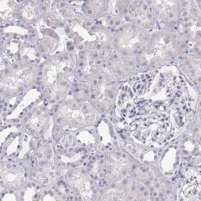 Immunohistochemistry-Paraffin: ANKRD65 Antibody [NBP2-39062]