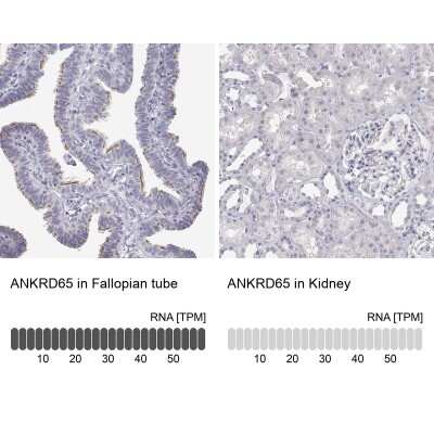 Immunohistochemistry-Paraffin: ANKRD65 Antibody [NBP2-39062]
