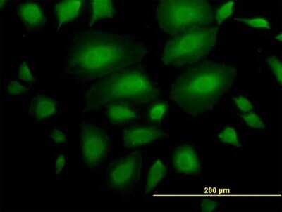 Immunocytochemistry/ Immunofluorescence: ANKS1A Antibody [H00023294-B01P]