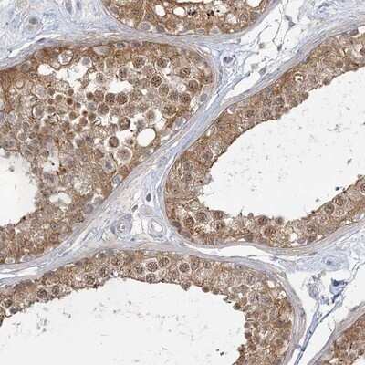 Immunohistochemistry-Paraffin: ANKS1A Antibody [NBP1-89077]