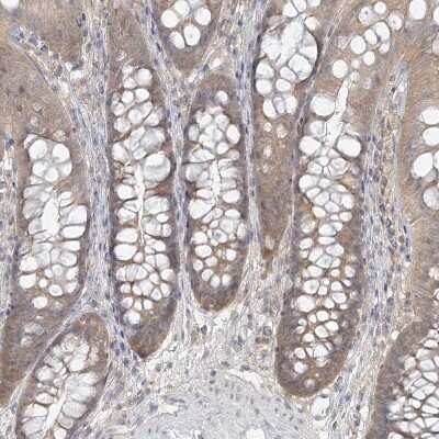 Immunohistochemistry-Paraffin: ANKS1A Antibody [NBP1-89077]