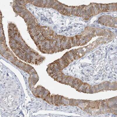Immunohistochemistry-Paraffin: ANKS1A Antibody [NBP1-89077]