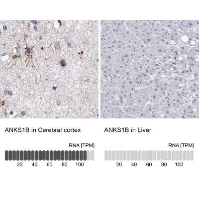 Immunohistochemistry-Paraffin: ANKS1B Antibody [NBP3-17099]
