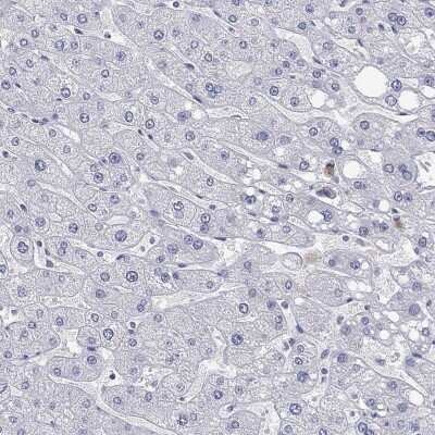 Immunohistochemistry-Paraffin: ANKS1B Antibody [NBP3-17099]