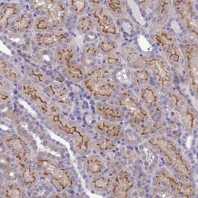 Immunohistochemistry-Paraffin: ANKS4B Antibody [NBP1-91672]