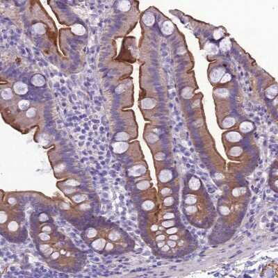 Immunohistochemistry-Paraffin: ANKS4B Antibody [NBP1-91672]
