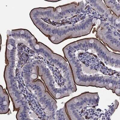 Immunohistochemistry-Paraffin: ANKS4B Antibody [NBP3-17132]